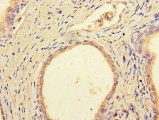 DCAF8 Antibody