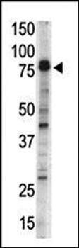 DCAMKL1 antibody
