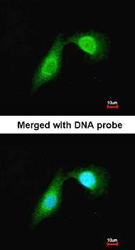 DCAMKL2 antibody