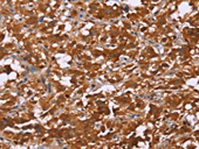 DCBLD2 antibody