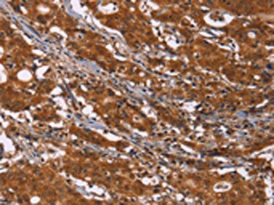 DCBLD2 Antibody