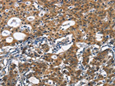 DCC Antibody