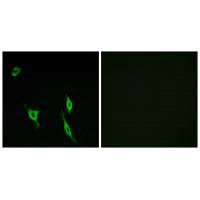 DCC Antibody