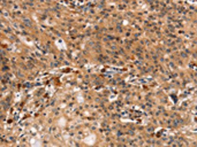 DCLK1 Antibody