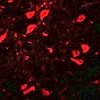 DCLK3 Rabbit Polyclonal Antibody