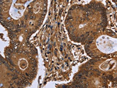 DCP1A Antibody