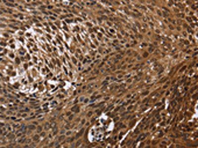 DCP1A Antibody