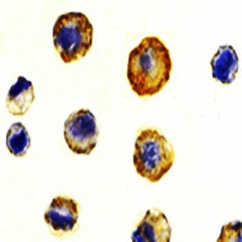 DcR1 Antibody