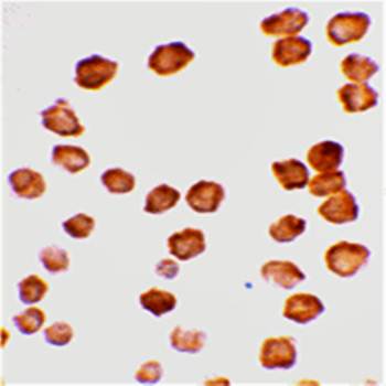 DcR2 Antibody