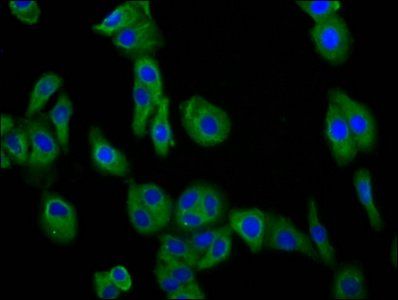 DCSTAMP antibody