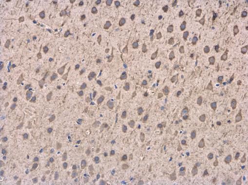 DCTN1 antibody [C3], C-term