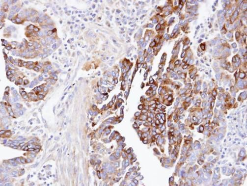 DCTN1 antibody [C3], C-term
