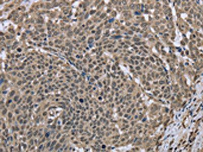 DCTN4 Antibody