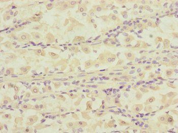 DCTN6 Antibody