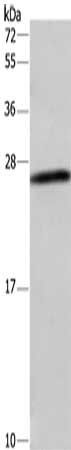 DCTN6 Antibody
