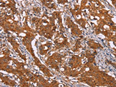 DCTN6 Antibody
