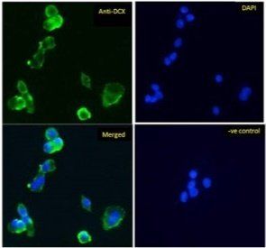 Doublecortin antibody