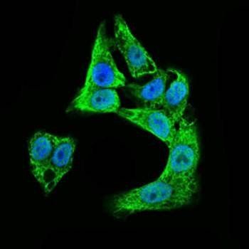 DCX Antibody