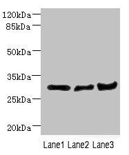 DCXR Antibody
