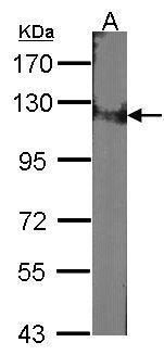 damage specific DNA binding protein 1 Antibody