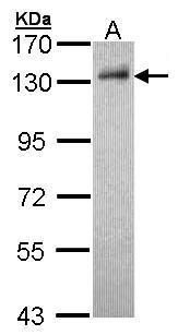 damage specific DNA binding protein 1 Antibody