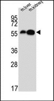 DDC antibody