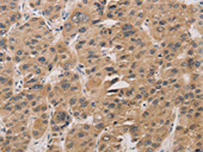DDIT4 Antibody