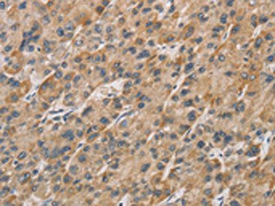 DDIT4L Antibody