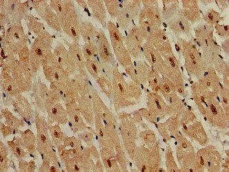DDR2 Antibody