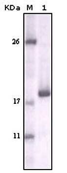 DDR2 Antibody