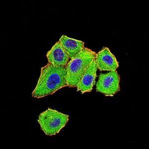 DDX1 Antibody