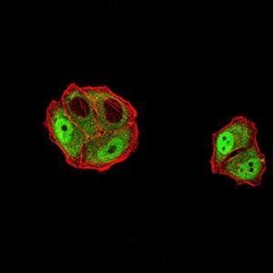 DDX1 Antibody