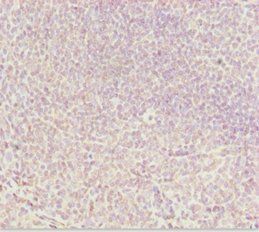 DDX11 antibody