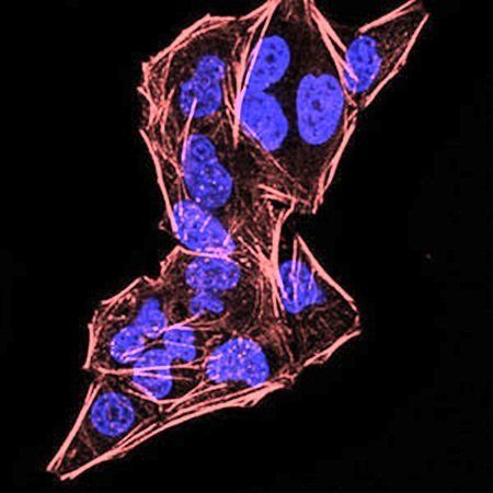 DDX20 Antibody