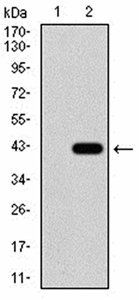 DDX20 Antibody