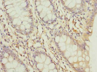 DDX20 Antibody