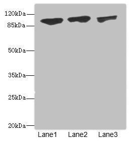DDX20 Antibody