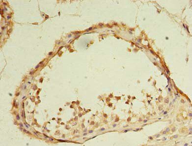 DDX31 Antibody