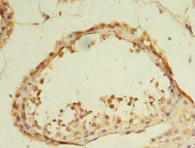 DDX31 antibody