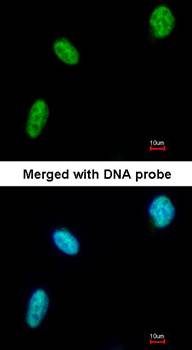 DDX39 antibody