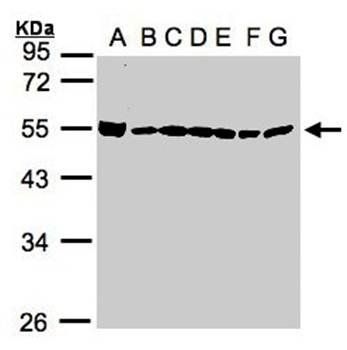 DDX39 Rabbit Polyclonal Antibody