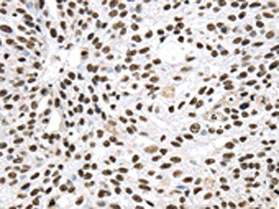 DDX39B Antibody