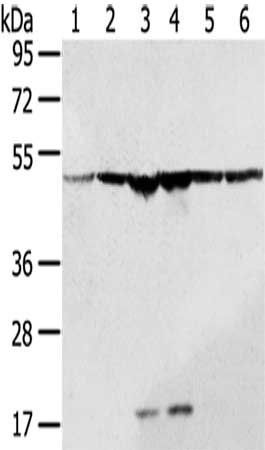 DDX39B Antibody