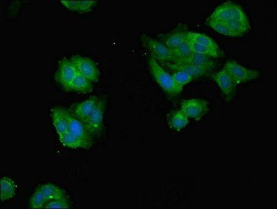 DDX3X Antibody