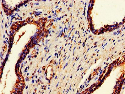 DDX3X Antibody