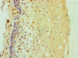 DDX3X Antibody