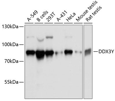 DDX3Y antibody