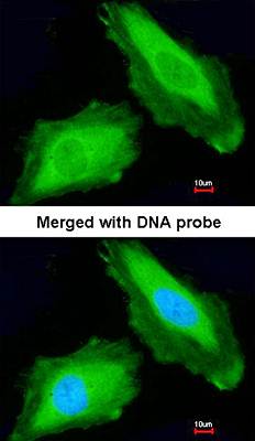 DDX3Y antibody