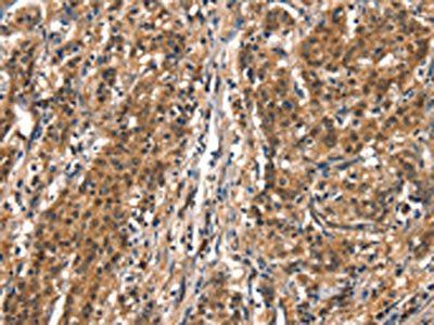 DDX4 Antibody