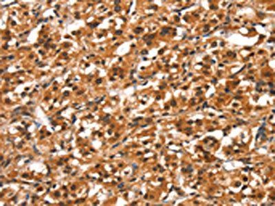 DDX4 Antibody